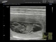 Op 1 september 2015 hebben we een echo laten maken - N-nest 2016 - foto 1 Op 1 september 2015 hebben we een echo laten maken - N-nest 2016 - foto 1