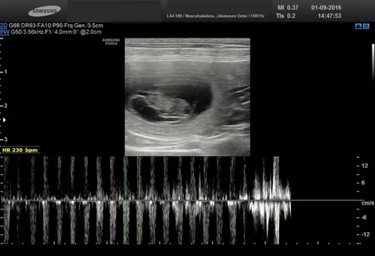 een echo van heaven met hartslagjes een echo van heaven met hartslagjes