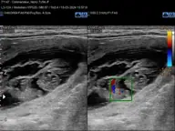 Op 18 maart 2024 hebben we een echo laten maken, hierop waren 9 pupjes te zien - V-nest 2024 - foto 1 Op 18 maart 2024 hebben we een echo laten maken, hierop waren 9 pupjes te zien - V-nest 2024 - foto 1